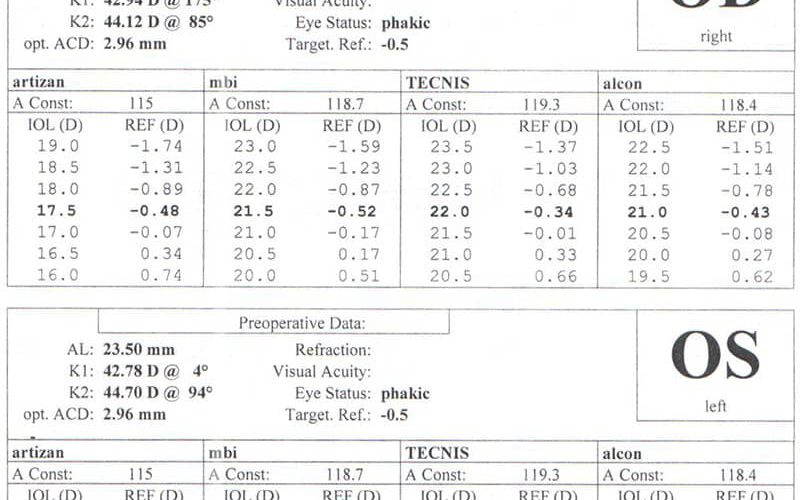 Iolmaster Chart دستگاه سونوگرافی IOL MASTER - کلینیک فوق تخصصی چشم دکتر حبیب جعفری